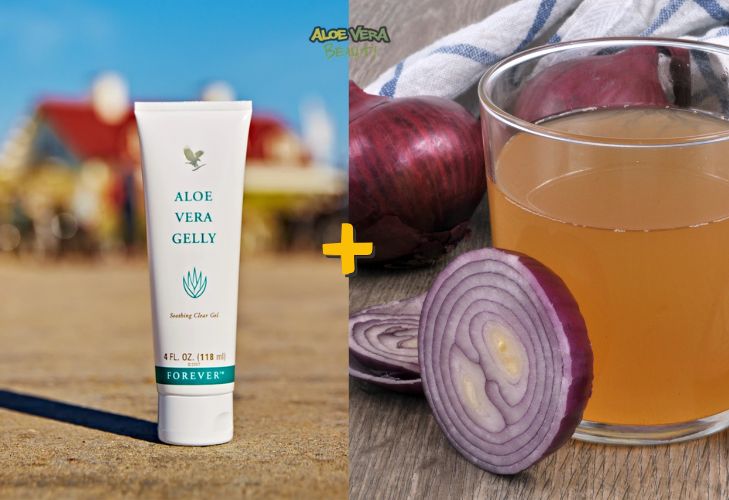 Traitement repousse cheveux au gel d’aloe vera et à l’oignon