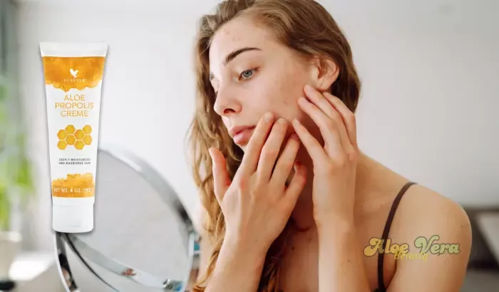 Aloe Propolis Crème appliquée pour apaiser les rougeurs et réduire les irritations de la peau.