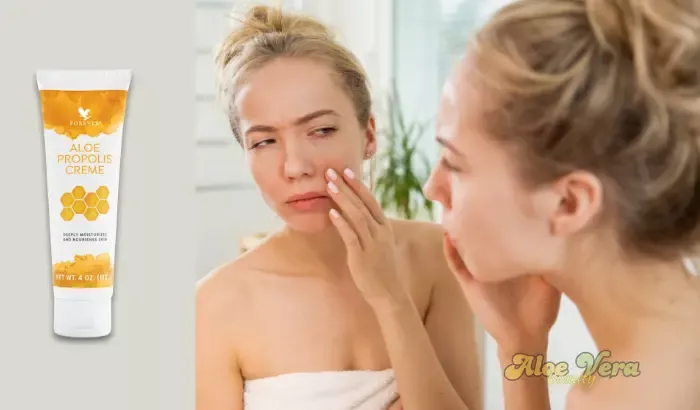 Soulagement des irritations grâce à l’Aloe Propolis Crème, idéale pour calmer les rougeurs du visage.