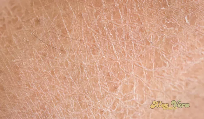 Aloe Propolis Crème nourrissant intensément les peaux sèches et réactives pour plus de confort au quotidien.