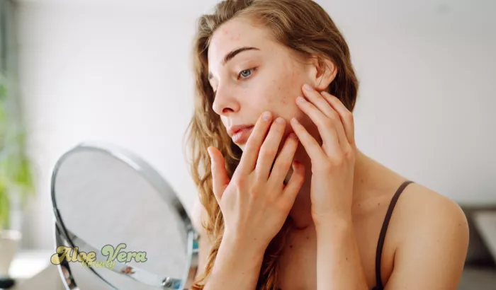 Aloe Propolis Crème pour Traiter les Imperfections