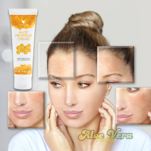Les Bienfaits Surprenants De L'aloe Propolis Crème Pour Traiter Les Imperfections
