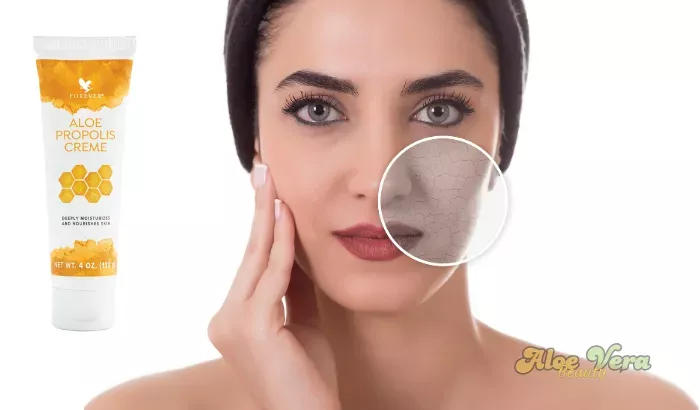 Aloe Propolis Crème utilisée comme soin multi-usages pour hydrater et apaiser la peau du visage et du corps.
