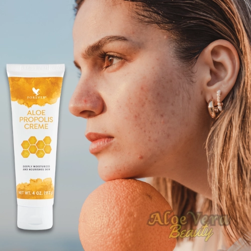 les bienfaits incroyables de la crème anti-acné aloe propolis