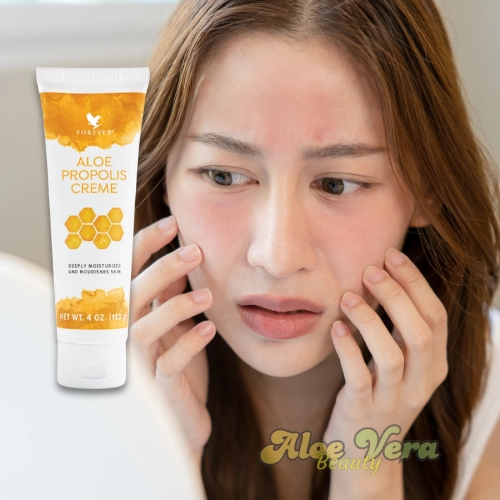 Pourquoi Aloe Propolis Crème Est La Meilleure Solution Pour Les Peaux Sensibles